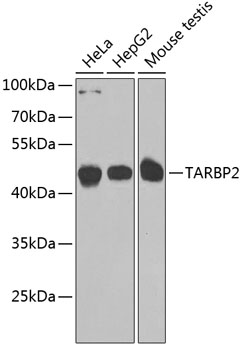TARBP2 Polyclonal Antibody