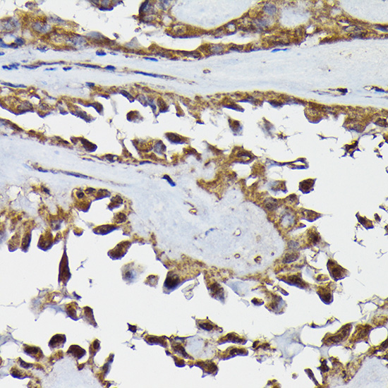 TARBP2 Polyclonal Antibody
