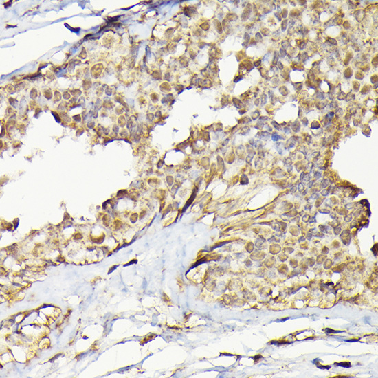 TARBP2 Polyclonal Antibody