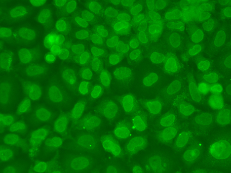 TARBP2 Polyclonal Antibody