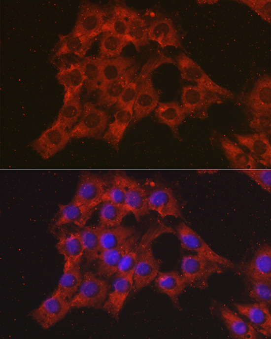 CCL3 Polyclonal Antibody