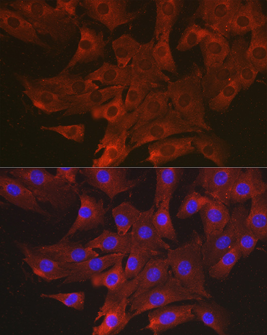CCL3 Polyclonal Antibody