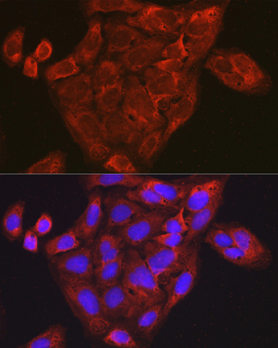 CCL3 Polyclonal Antibody