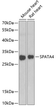 SPATA4 Polyclonal Antibody
