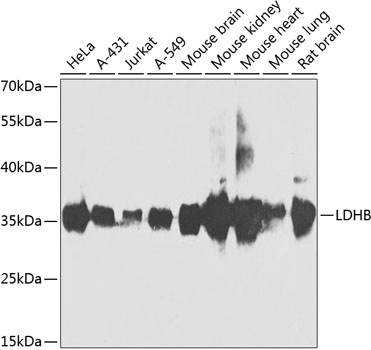 LDHB Polyclonal Antibody