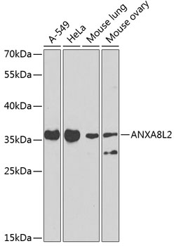ANXA8L2 Polyclonal Antibody