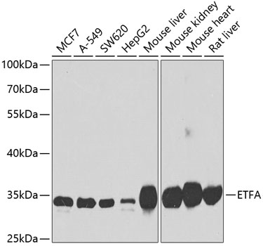 ETFA Polyclonal Antibody