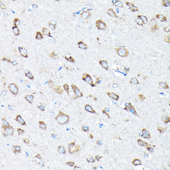 ETFA Polyclonal Antibody