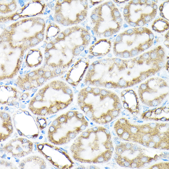 ETFA Polyclonal Antibody