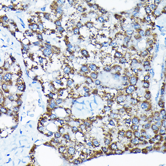 ETFA Polyclonal Antibody