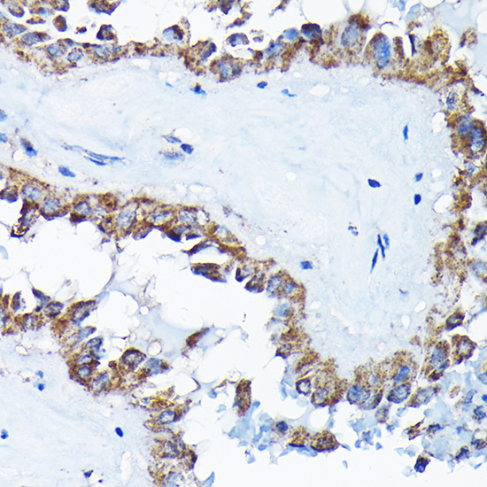ETFA Polyclonal Antibody