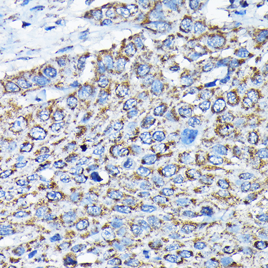 ETFA Polyclonal Antibody