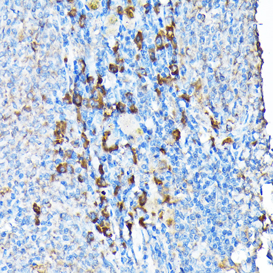 ETFA Polyclonal Antibody