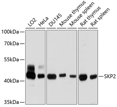 SKP2 Polyclonal Antibody