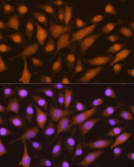 SKP2 Polyclonal Antibody