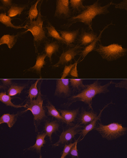 SKP2 Polyclonal Antibody