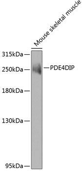 PDE4DIP Polyclonal Antibody