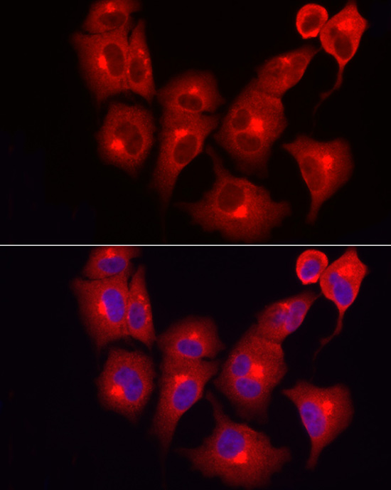 INPP5K Polyclonal Antibody