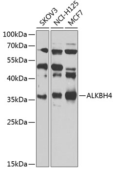 ALKBH4 Polyclonal Antibody
