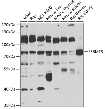 FERMT3 Polyclonal Antibody