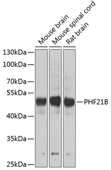 PHF21B Polyclonal Antibody