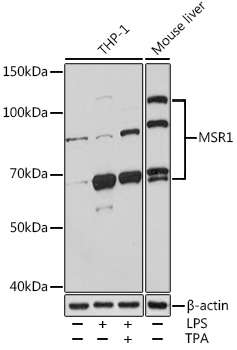 NCAM1 / CD56 Polyclonal Antibody