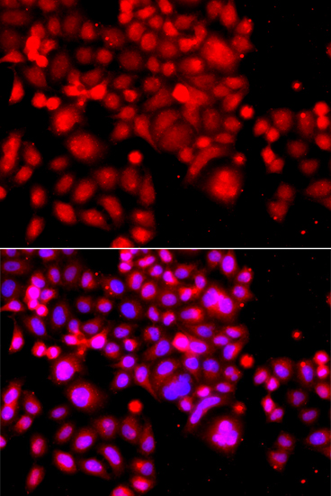 ASCC3 Polyclonal Antibody