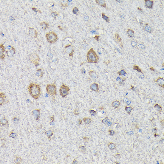 MTHFD1L Polyclonal Antibody