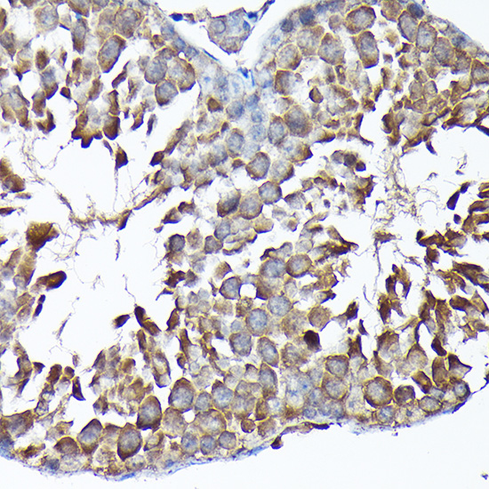 MTHFD1L Polyclonal Antibody