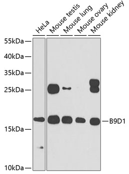 B9D1 Polyclonal Antibody