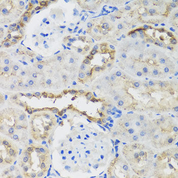 B9D1 Polyclonal Antibody