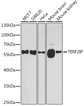 TERF2IP Polyclonal Antibody