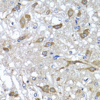 OSGEPL1 Polyclonal Antibody