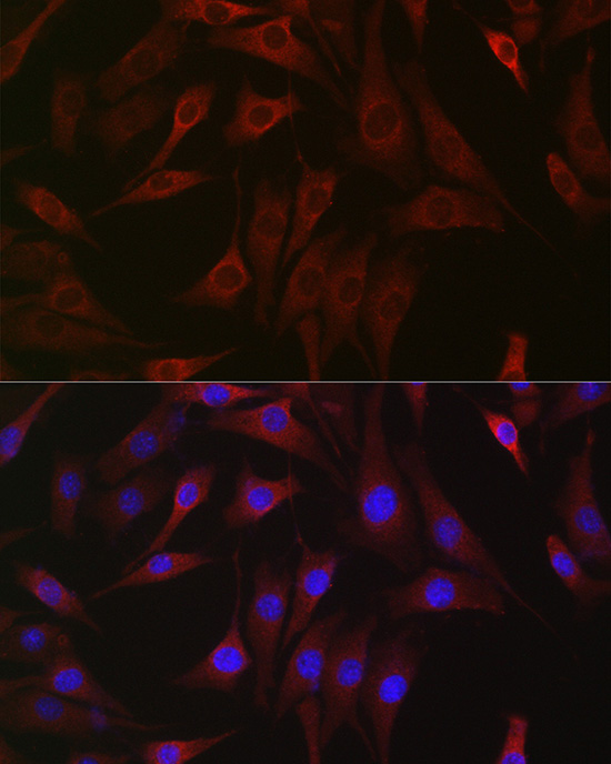DDIT4 Polyclonal Antibody