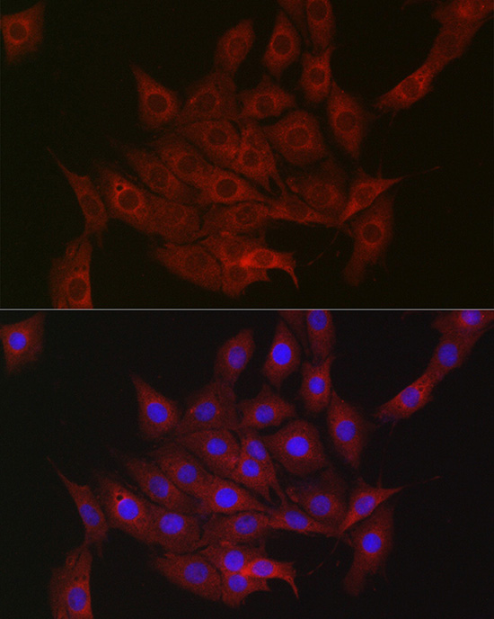 DDIT4 Polyclonal Antibody