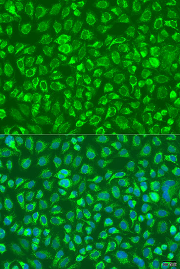 C5 Polyclonal Antibody