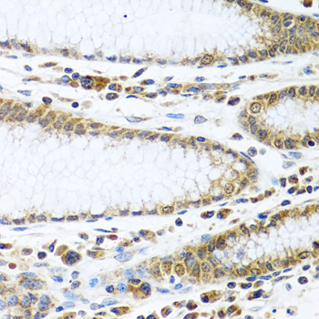 IFI44 Polyclonal Antibody