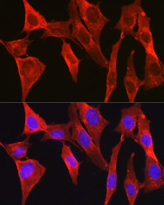 DAPK2 Polyclonal Antibody