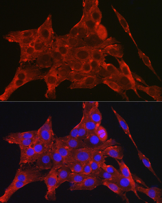 DAPK2 Polyclonal Antibody