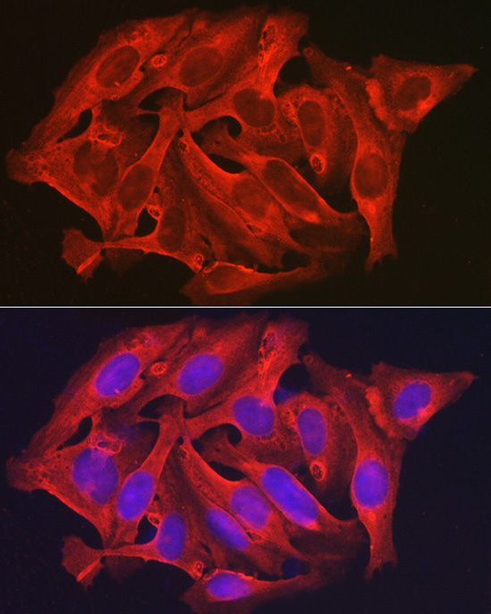 DAPK2 Polyclonal Antibody