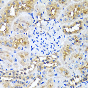 NIN Polyclonal Antibody