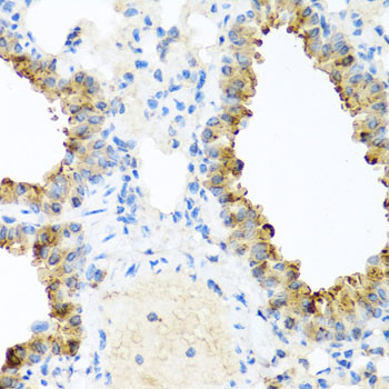 NIN Polyclonal Antibody