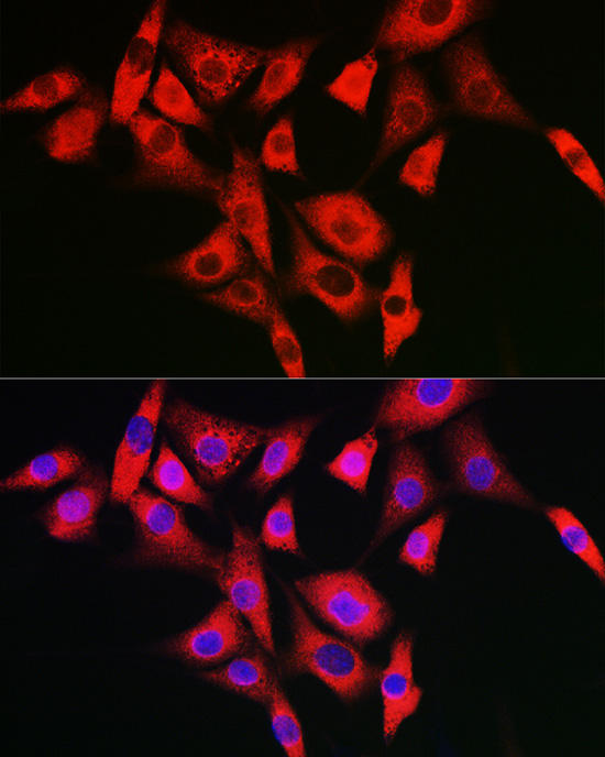 NLRP2 Polyclonal Antibody