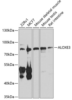 ALOXE3 Polyclonal Antibody
