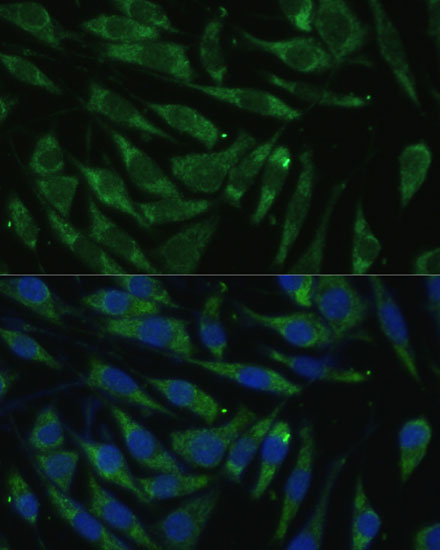 PITRM1 Polyclonal Antibody