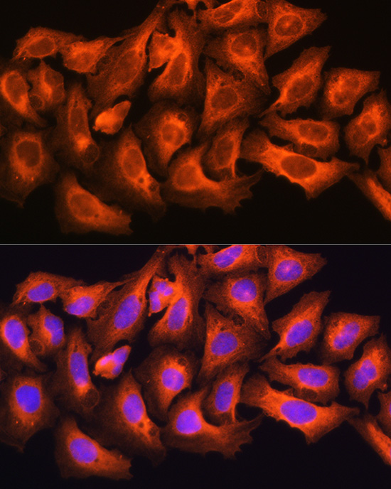 CKAP5 Polyclonal Antibody