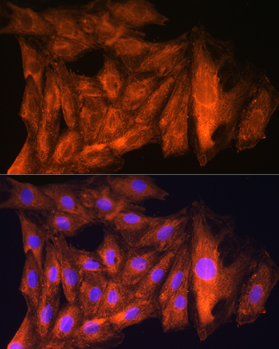 CKAP5 Polyclonal Antibody