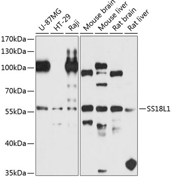 SS18L1 Polyclonal Antibody