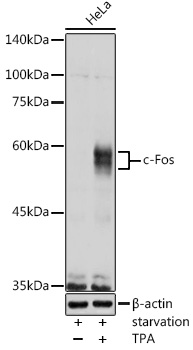 FOS Antibody