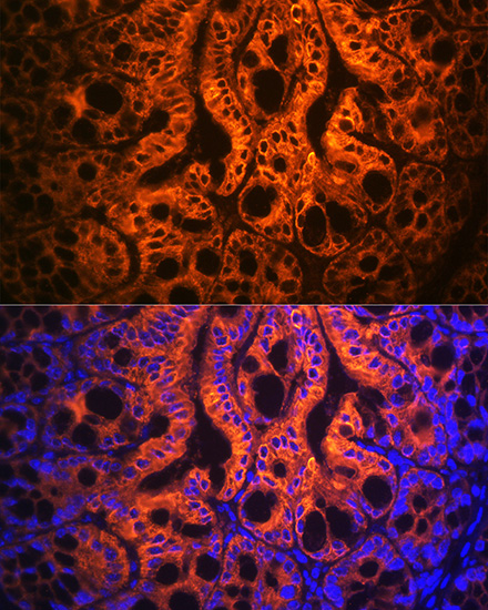 KRT19 Antibody